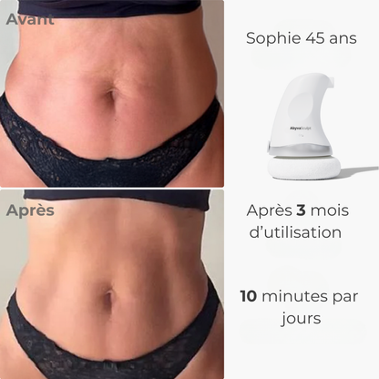 AbyvaSculpt™ - 2.0